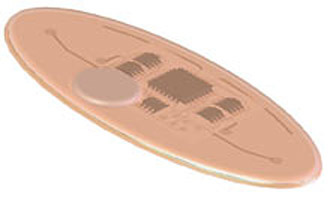 philometron